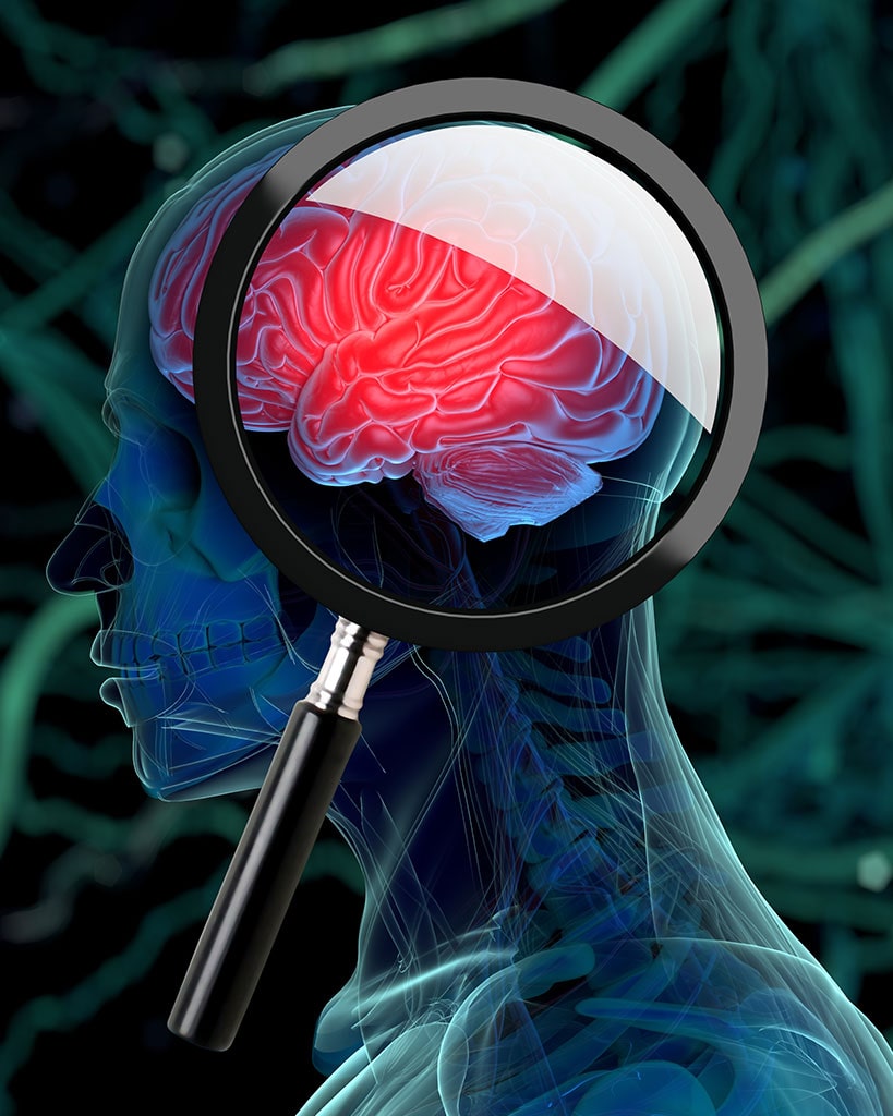 Diagnostics