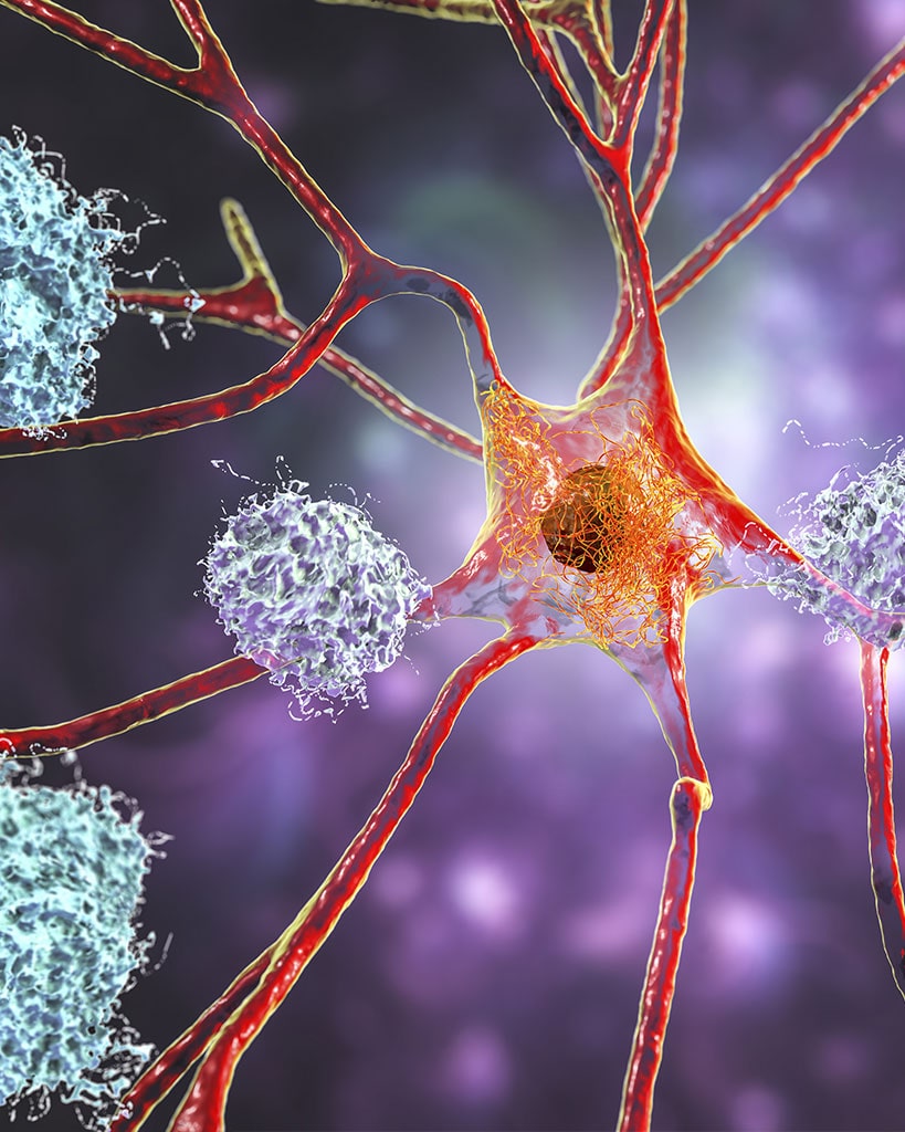 Neuroregeneration